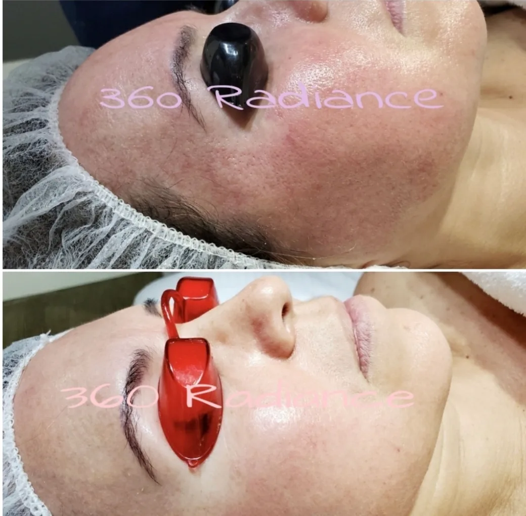 Medical-grade LED light therapy treatment in progress at 360 Radiance